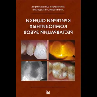 Критерии оценки композитных реставраций зубов. / Николаев А.И.