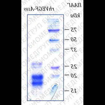 Фактор роста эндотелия сосудовА человека, изоформа 189, рекомбинантный белок, rhVEGFA189, Россия, PSG15010, 10 мкг