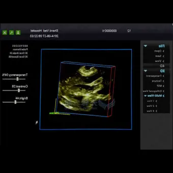 Медицинское программное обеспечение 3D