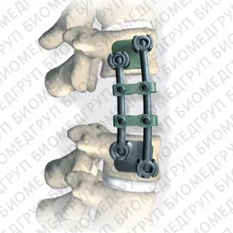 Stryker XIA anterior Пластина