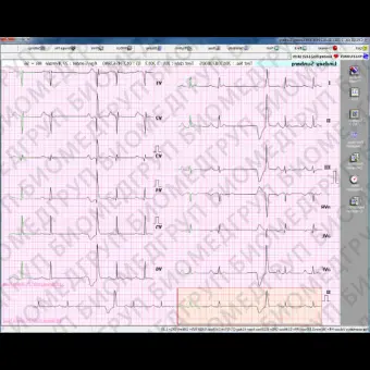 Программное обеспечение для электрокардиографии CVS03