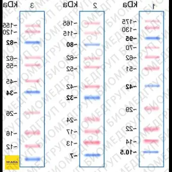 Маркеры белковые молекулярного веса, предокрашенные, Prism Ultra, 10175 кДа, 11 полос, Abcam, ab115832, 500 мкл