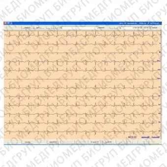 Медицинское программное обеспечение CardioTEKA