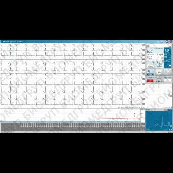 Программное обеспечение для диагностической станции сердечнодыхательной деятельности PADSY Ergo