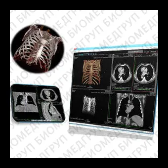 Программное обеспечение для рентгенологии VisionHM MPR Radiology