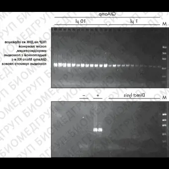 Набор для выделения ДНК из биологических образцов малого объёма QIAamp DNA Miсro Kit, Qiagen, 56304, 50 выделений