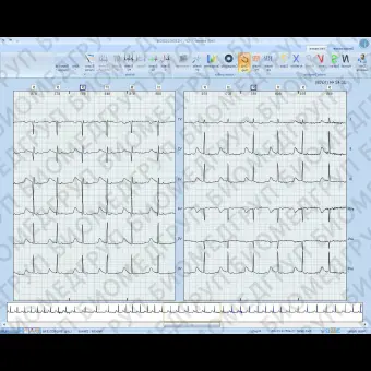Программное обеспечение для холтеровского монитора EUROHOLTER SW3/12