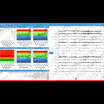 Медицинское программное обеспечение NeuroCenter