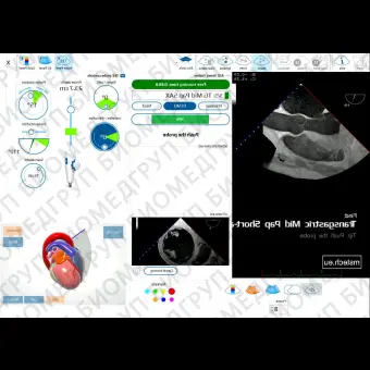 Медицинское программное обеспечение eTEEmothy