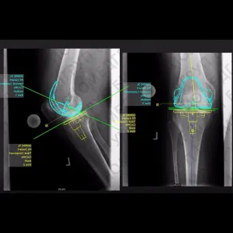 Программное обеспечение для системы архивации и передачи изображений mediCAD 2D Classic