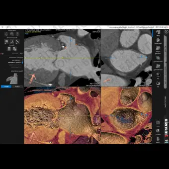 Медицинский модуль программного обеспечения 3mensio LAA