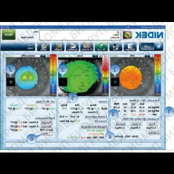 Роговичный топограф OPDSCAN III