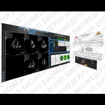 Программное обеспечение для кардиологии SUITESTENSA CVIS PACS