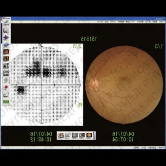 Офтальмологический периметр AP7000