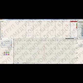 Кардиомонитор Холтера 12 каналов BTL CardioPointHolter H600