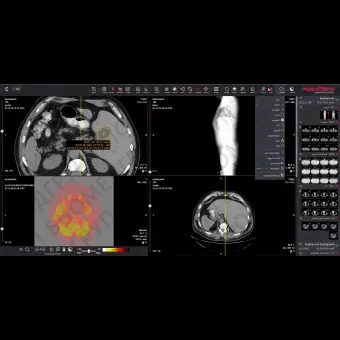 Медицинское программное обеспечение MedDream WEB DICOM