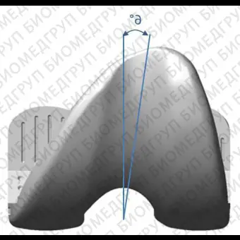 Коленный протез с 3 отсеками ANATOMIC