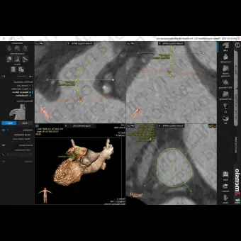 Медицинский модуль программного обеспечения 3mensio LAA