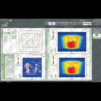 Программное обеспечение для радиационной терапии myQA Platform
