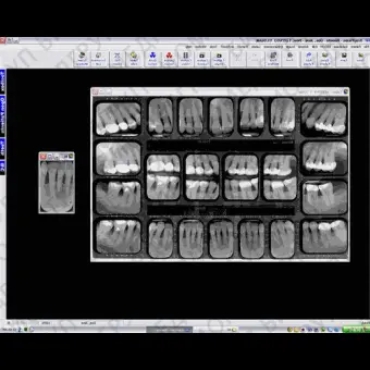 Программное обеспечение для обработки снимков зубов XrayVision