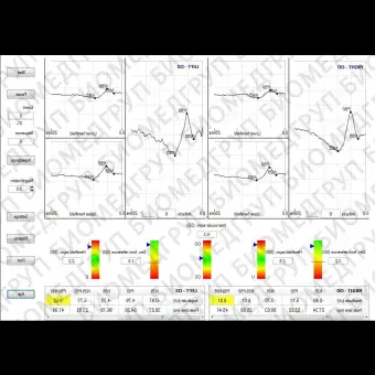 Электроретинограф с электроокулографом RETIMAX