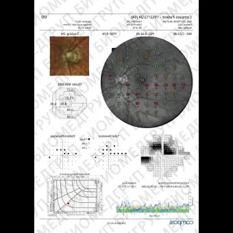 Офтальмологический микропериметр COMPASS