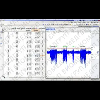 Программное обеспечение для нейрофизиологического стимулирования NeuroScore