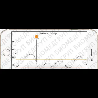 Глюкометр непрерывного действия Dexcom G5