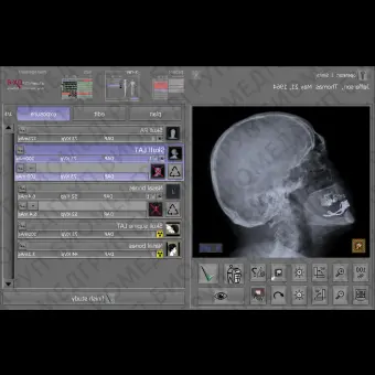 Программное обеспечение для медицинских снимков dicomPACSDXR