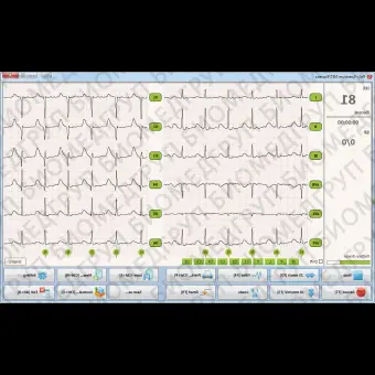Электрокардиограф для спокойного состояния POLYSPECTRUM8/EX