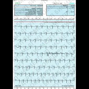 Кардиомонитор Холтера 1 канал SAVVY ECG