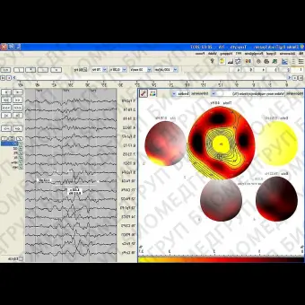 Неврологическое программное обеспечение EEG DigiTrack