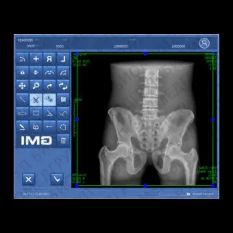 Программное обеспечение для медицинских снимков DXRay