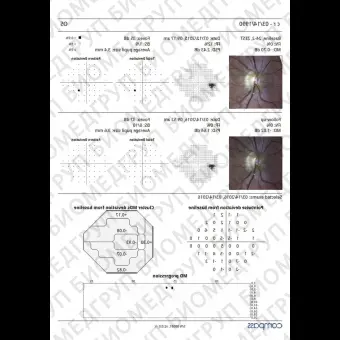 Офтальмологический микропериметр COMPASS