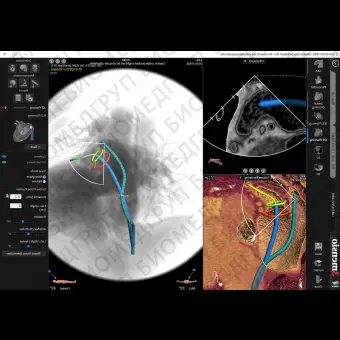 Медицинский модуль программного обеспечения 3mensio LAA