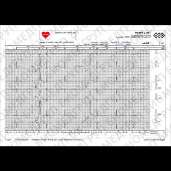 Кардиомонитор Холтера 12 каналов BTL CardioPointHolter H600