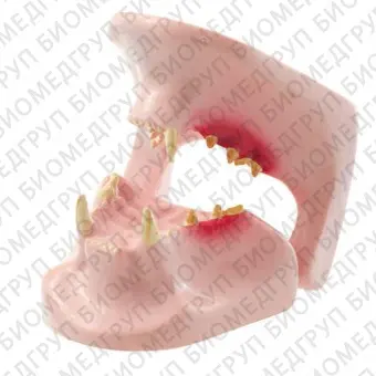 Анатомическая модель прорезывание зубов H190051