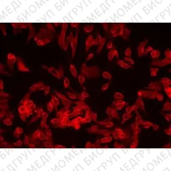 Набор для окраски плазматической мембраны Orange Fluorescence  Cytopainter, Abcam, ab219941, 500 тестов