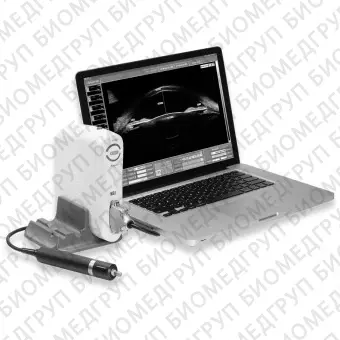 Переносной ультразвуковой сканер SW3200S