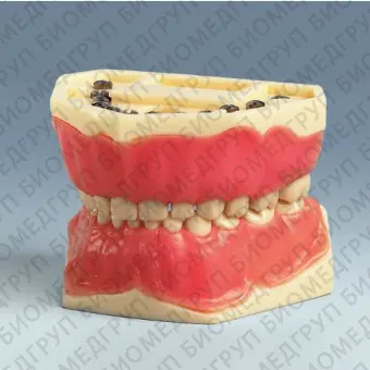 Анатомическая модель прорезывание зубов AK6/2