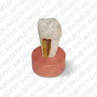DM26 увеличенная модель зуба со вкладкой для демонстрации, высота 9 см.