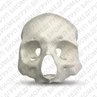 E51 модель верхней челюсти, скул и лобной кости для практики скуловых имплантов