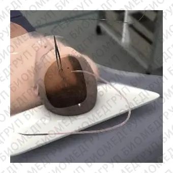 Приложение iOS для нейрохирургии External Ventricular Drain