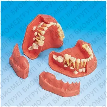 Анатомическая модель прорезывание зубов PEPDI004