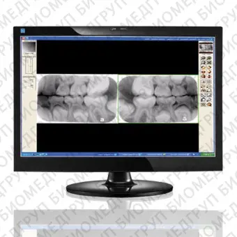 Программное обеспечение для обработки снимков зубов Visix