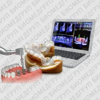 Программное обеспечение для управляемой хирургии Implant3D