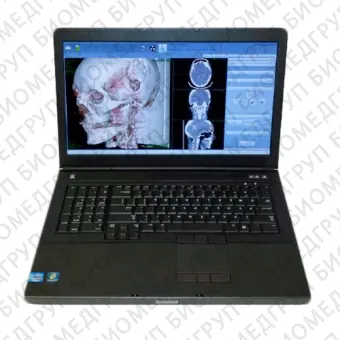 NeuroLogica CereTom Компьютерный томограф