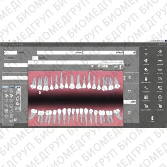 Программное обеспечение для обработки снимков зубов Quickvision