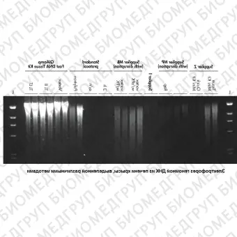 Набор для выделения ДНК из тканей QIAamp Fast DNA Tissue Kit, Qiagen, 51404, 50 выделений
