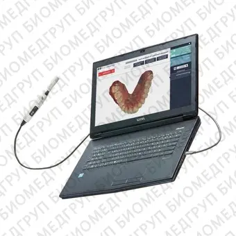Condor  интраоральный сканер, ноутбук в комплекте